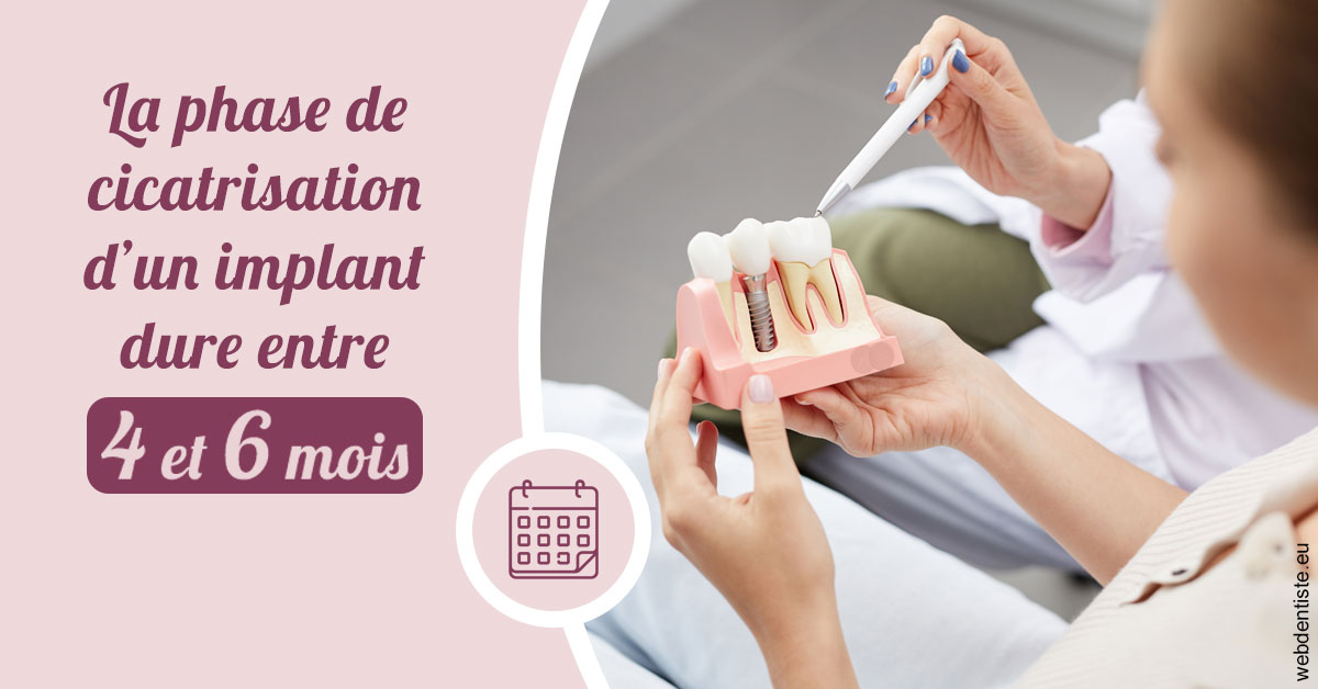 https://dr-marcais-yvick.chirurgiens-dentistes.fr/Cicatrisation implant 2