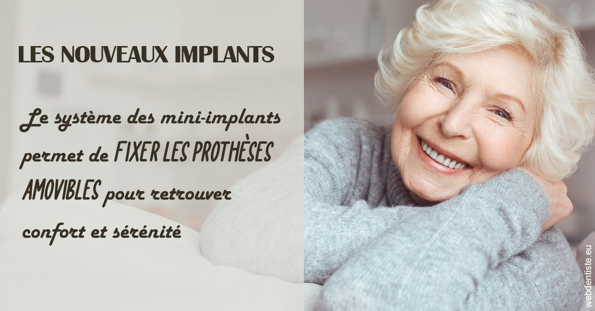 https://dr-marcais-yvick.chirurgiens-dentistes.fr/Les nouveaux implants 1
