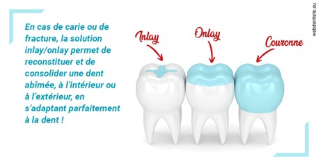 https://dr-marcais-yvick.chirurgiens-dentistes.fr/L'INLAY ou l'ONLAY