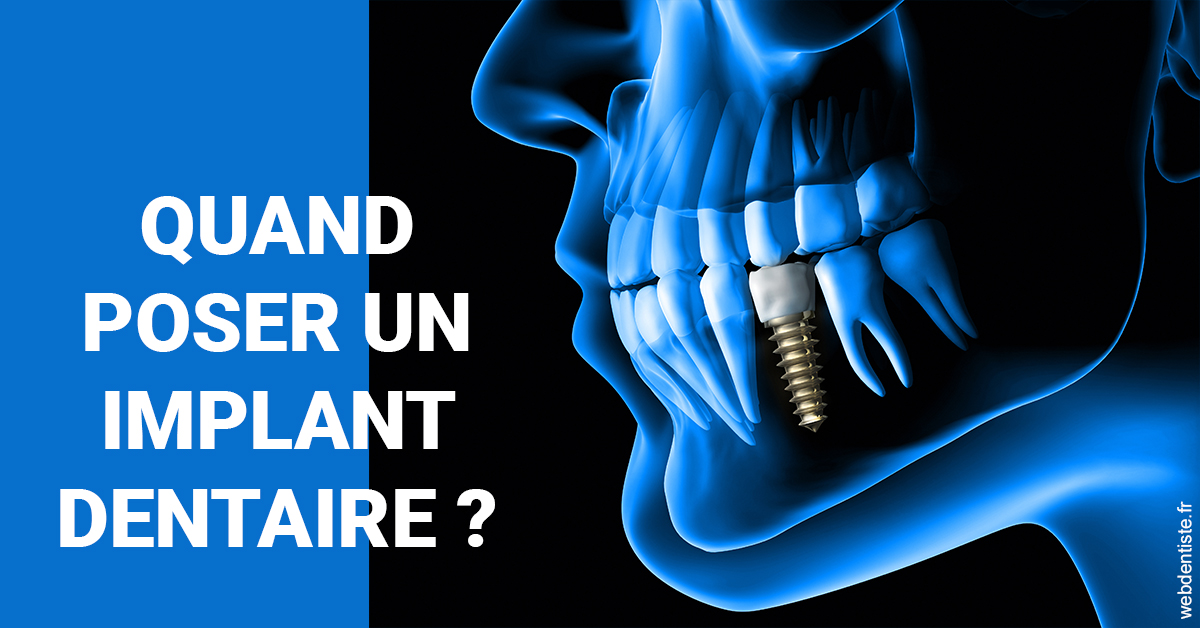 https://dr-marcais-yvick.chirurgiens-dentistes.fr/Les implants 1