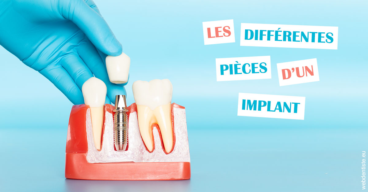 https://dr-marcais-yvick.chirurgiens-dentistes.fr/Les différentes pièces d’un implant 2