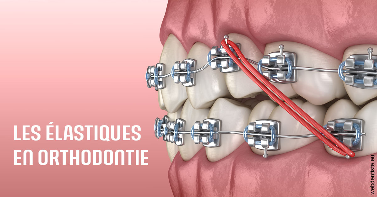 https://dr-marcais-yvick.chirurgiens-dentistes.fr/Elastiques orthodontie 2