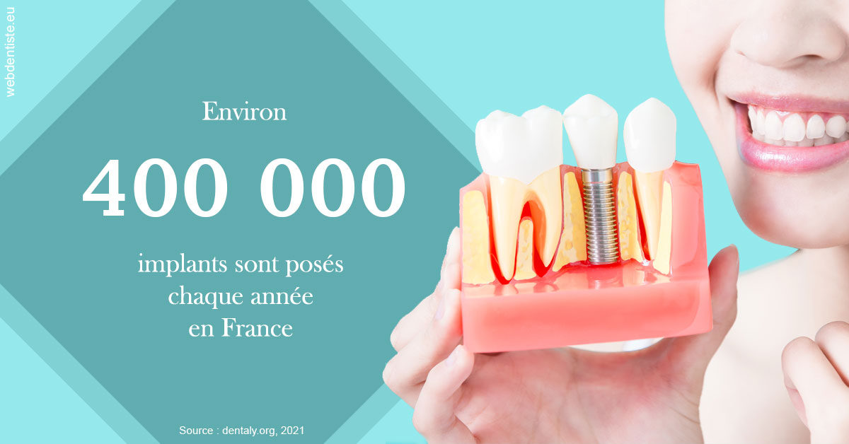 https://dr-marcais-yvick.chirurgiens-dentistes.fr/Pose d'implants en France 2
